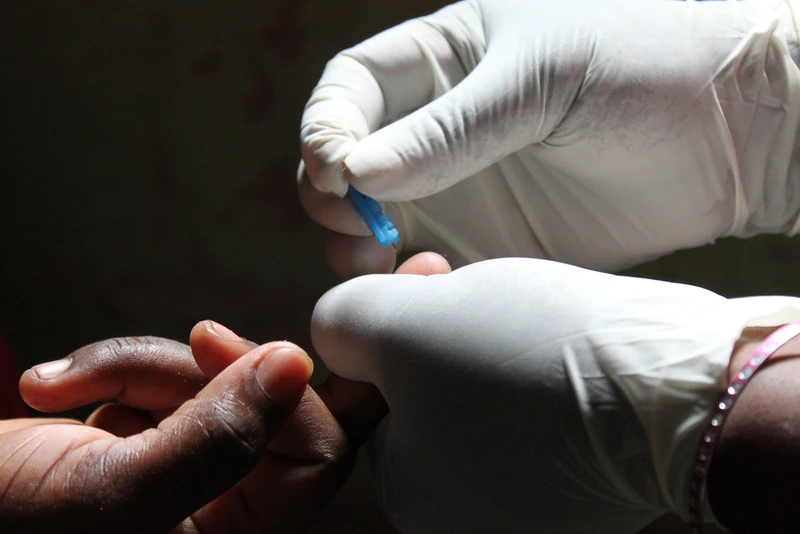 Thời điểm xét nghiệm HIV có kết quả chính xác là khi nào? Ai cần xét nghiệm HIV? 4