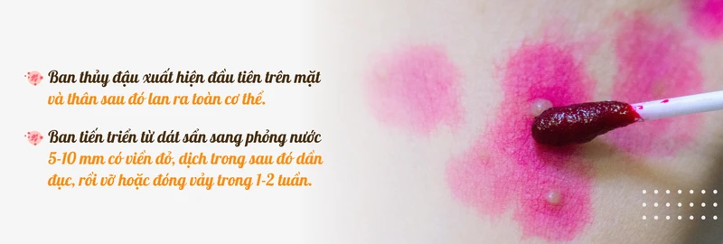 thuy-dau-1.png