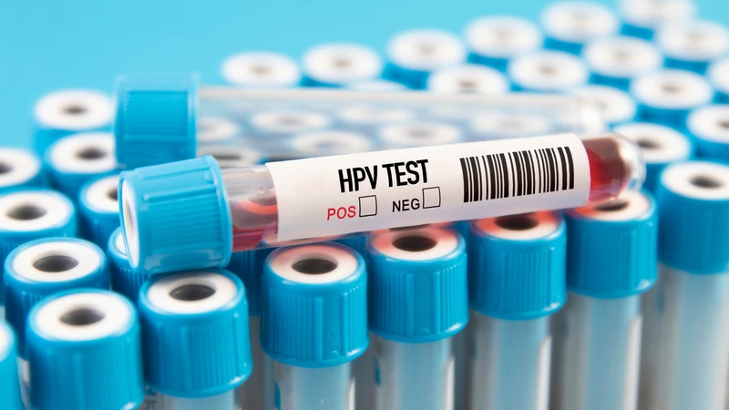Không cần thiết phải xét nghiệm HPV trước khi tiêm