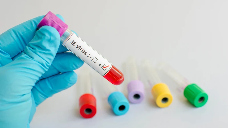 Viêm não Nhật Bản là bệnh truyền nhiễm do virus