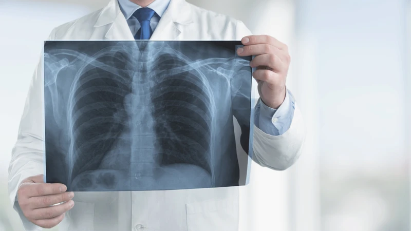 Tiểu phế quản: Cấu trúc, chức năng và bệnh lý liên quan 3