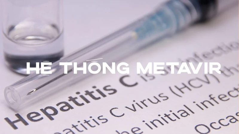 Tìm hiểu bệnh xơ gan có mấy giai đoạn và hướng điều trị phù hợp 4