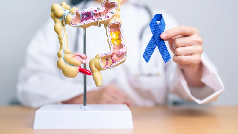 Tìm hiểu rằng ung thư đại tràng có lây không? 1