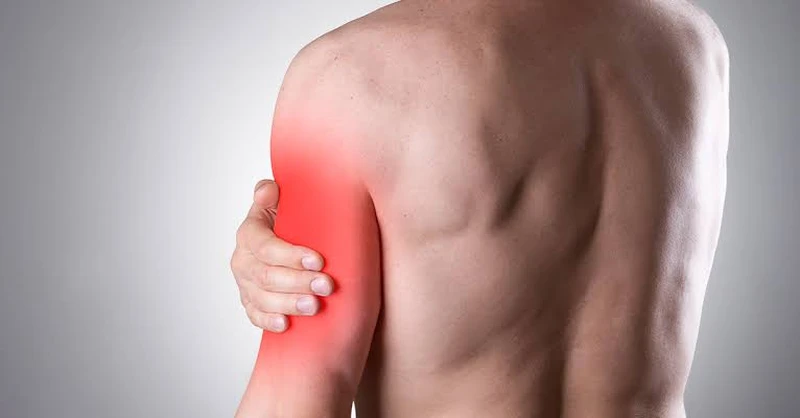 Viêm gân cơ tam đầu có thể biểu hiện bằng cơn đau nhức âm ỉ vùng mặt sau khuỷu tay