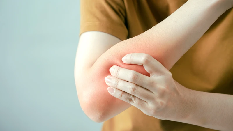 Sưng và đau ở cánh tay có thể là dấu hiệu của huyết khối tĩnh mạch