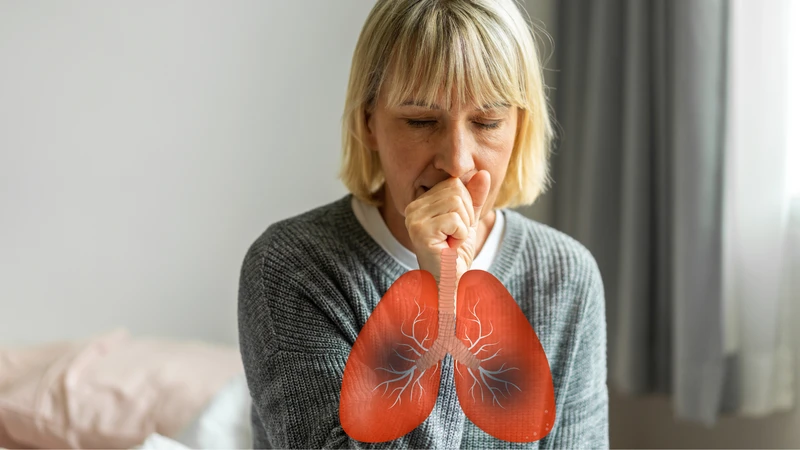 Tình trạng giãn phế quản sau lao phổi là gì? Biện pháp nào phòng bệnh lao phổi hiệu quả 1