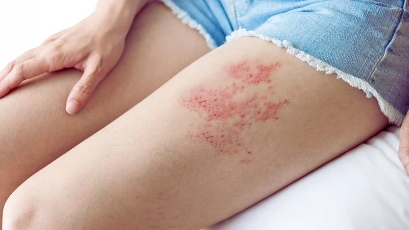 Tổn thương dây thần kinh là gì? Những thông tin cần biết 2