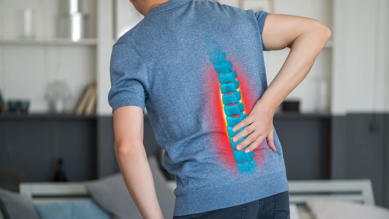 Tổn thương đĩa đệm gây áp lực lên dây thần kinh tọa, dẫn đến đau nhức