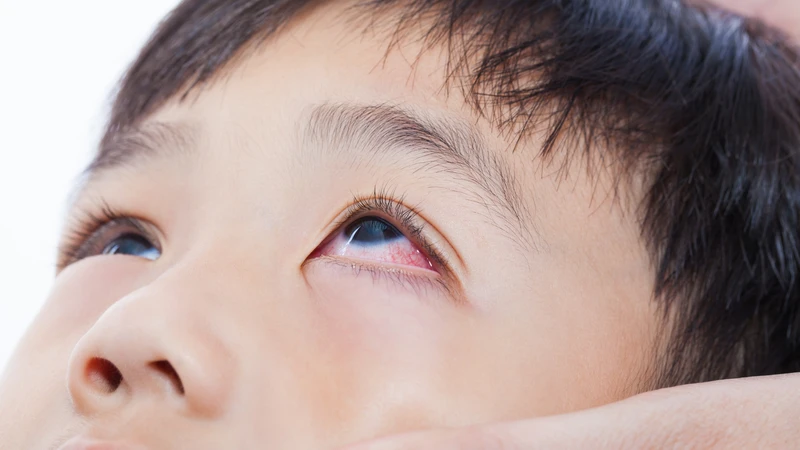 Toxocara cati có thể tác động đến võng mạc, gây đỏ mắt, nhìn mờ, giảm thị lực