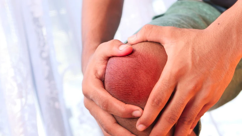 Tràn dịch khớp gối làm gối sưng, đau và hạn chế vận động