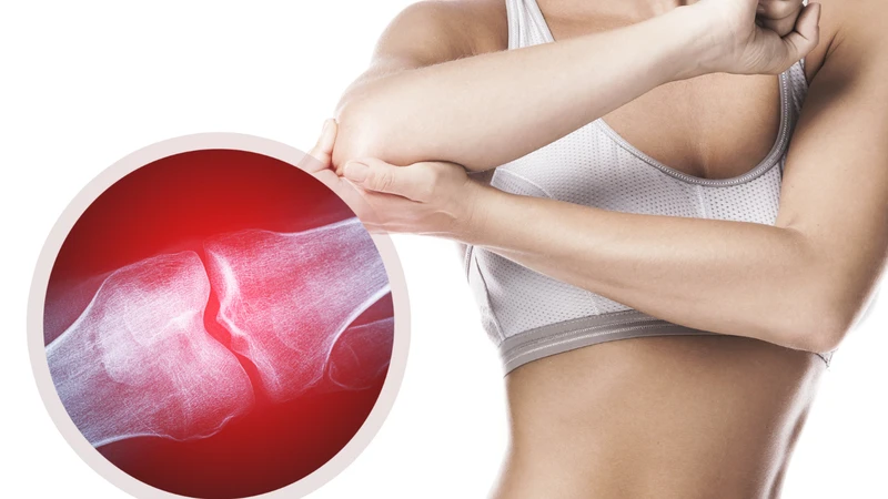 Tràn dịch khớp khuỷu tay gây tích tụ dịch bất thường trong ổ khớp
