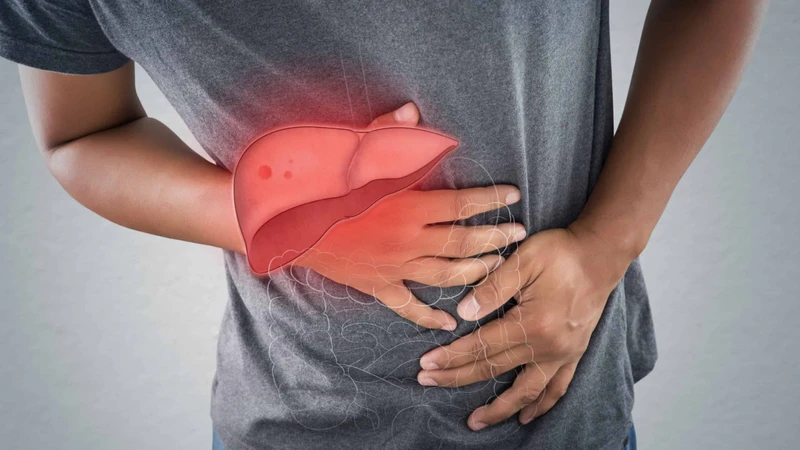 Nhóm người mắc xơ gan có nguy cơ cao nhất bị tràn dịch màng bụng