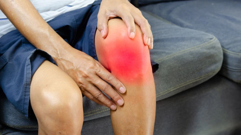 Đau dữ dội, sưng và biến dạng khớp gối là những dấu hiệu thường gặp