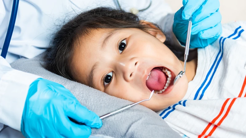 Bác sĩ thường cân nhắc giữ lại răng sữa khi lỗ sâu còn nhỏ hoặc trung bình