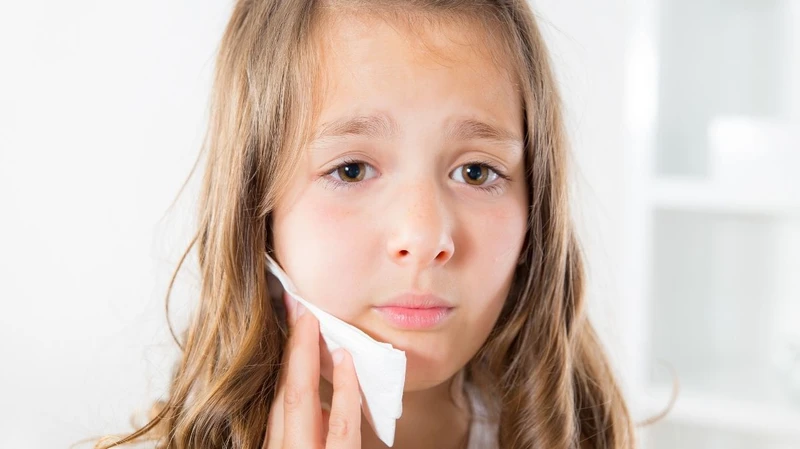 Nhiễm trùng răng miệng có thể làm môi trẻ sưng đau