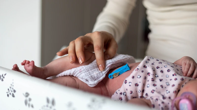 Trẻ sơ sinh bao lâu thì rụng rốn? Hướng dẫn cách chăm sóc rốn cho bé đúng cách 4