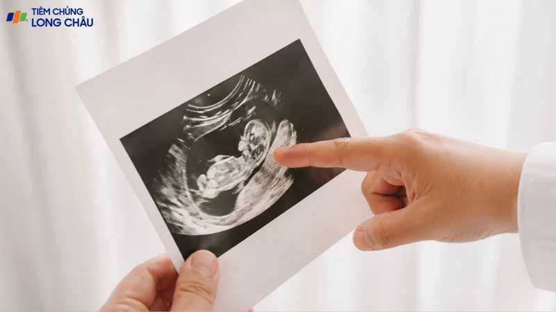 Trẻ sơ sinh có 3 tinh hoàn là biểu hiện của dị tật đa tinh hoàn hiếm gặp
