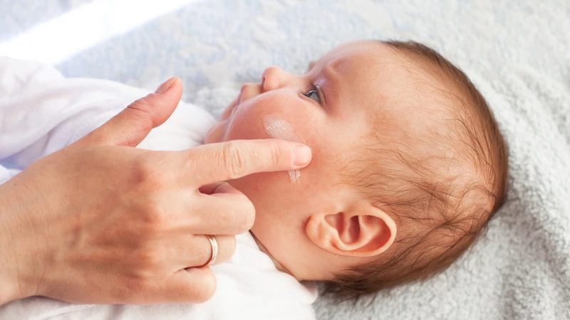Cha mẹ nên đưa trẻ đi khám nếu vết cào có dấu hiệu nhiễm trùng