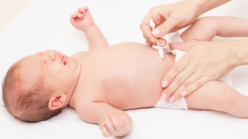 Trẻ sơ sinh rụng rốn nhưng chưa khô có sao không? 2