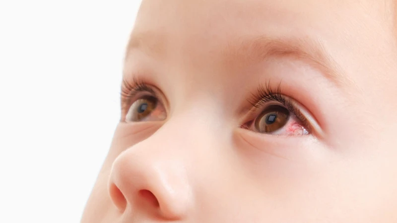 Trẻ sốt ho đỏ mắt có phải Adenovirus không? Những dấu hiệu cần lưu ý