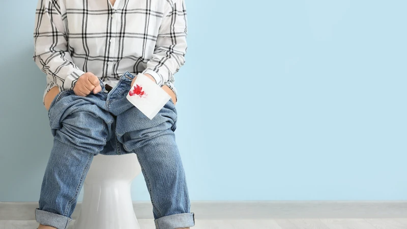 Trong một số trường hợp, búi trĩ huyết khối có thể bị rách hoặc vỡ, gây chảy máu nhiều và kéo dài