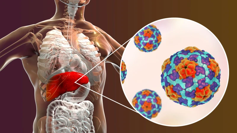 Virus viêm gan A (HAV) là một loại virus RNA không có vỏ bọc, có khả năng tồn tại khá bền vững trong môi trường