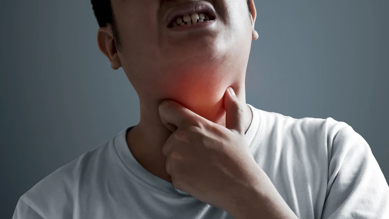 Ung thư khoang miệng sống được bao lâu? Các giai đoạn của ung thư miệng. 3