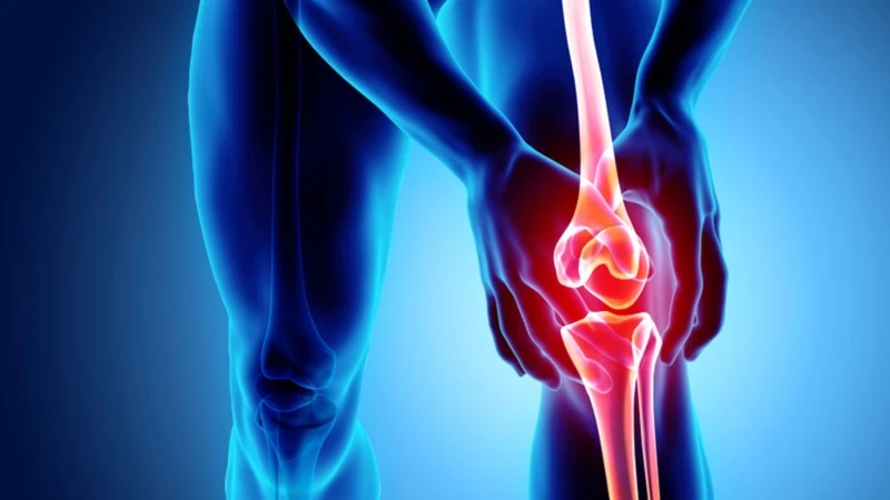 Thoái hóa khớp gối có thể gây tổn thương xương dưới sụn