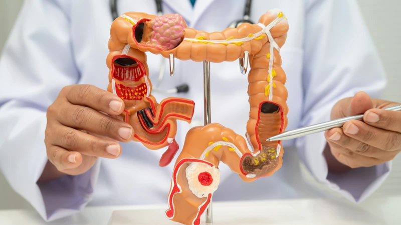 Vai trò của trực tràng và đại tràng trong quá trình tiêu hóa