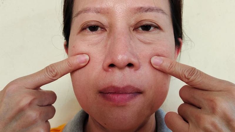 Đánh giá toàn diện vùng mặt giúp lựa chọn phương án cải thiện phù hợp hơn