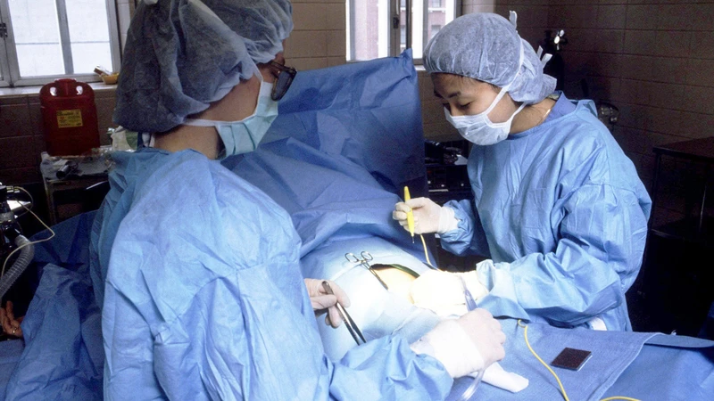 Những khuyết lõm tại vết mổ là nơi dễ bị ứ đọng dịch