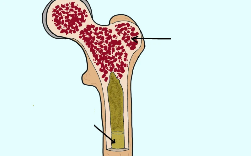 Có thể phân biệt tủy xương đỏ và tủy xương vàng dựa trên nhiều đặc điểm