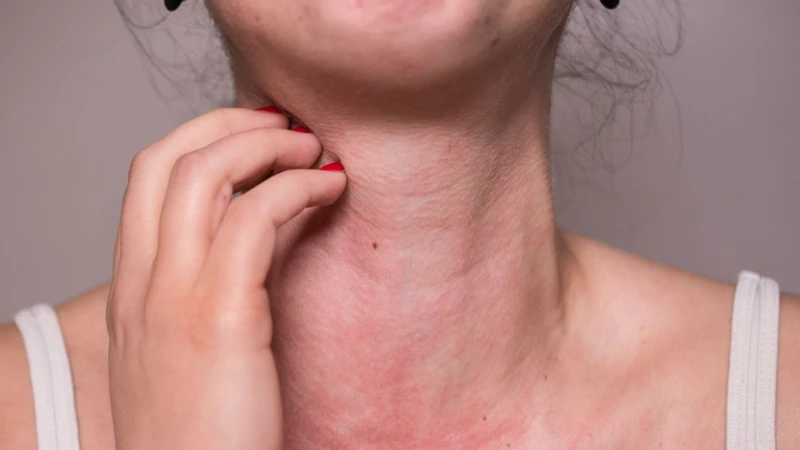 Dị ứng và viêm mạn tính là nguyên nhân phổ biến làm tăng bạch cầu ái kiềm