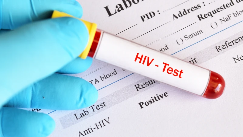 Xét nghiệm HIV là cách duy nhất để xác định chính xác tình trạng nhiễm bệnh
