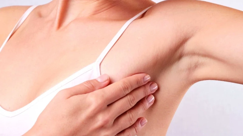Phần lớn u bã đậu ở nách là lành tính