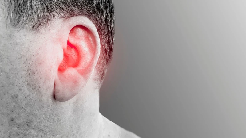 Tiền sử viêm tai ngoài là một trong các yếu tố làm tăng nguy cơ mắc u bã đậu ở tai