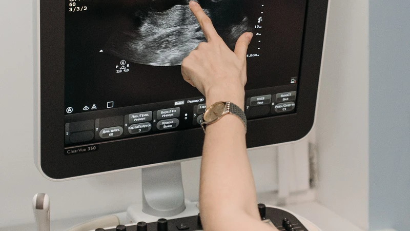 U cơ tuyến túi mật thường không có triệu chứng và được phát hiện tình cờ trong quá trình siêu âm