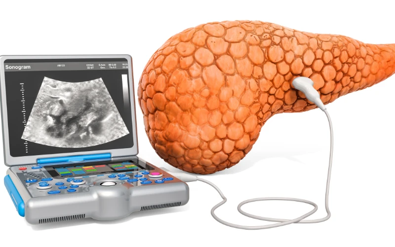 Đặc điểm hình thái khối u cũng giúp phân biệt u lành tính hay ác tính