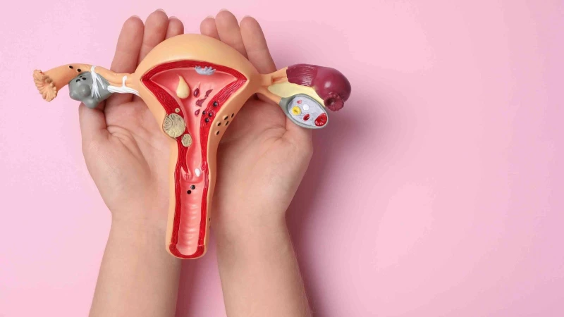 Ứ dịch vòi trứng là một bệnh lý phụ khoa ảnh hưởng đến ống dẫn trứng