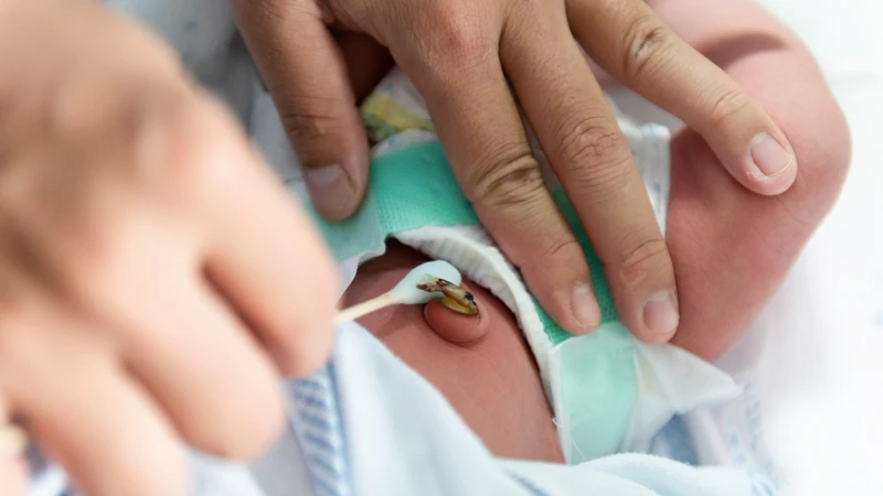 U hạt rốn thường không đau, không mủ, nhưng cần theo dõi sát để tránh biến chứng nhiễm khuẩn