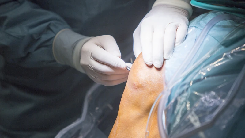 Phẫu thuật thường chỉ được cân nhắc khi các phương pháp khác không hiệu quả