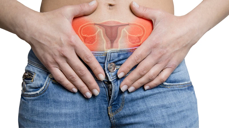 U nang buồng trứng có phải mổ không? 1