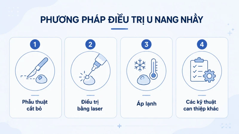 Bác sĩ sẽ lựa chọn phương pháp điều trị phù hợp dựa trên vị trí, kích thước và đặc điểm của u nang