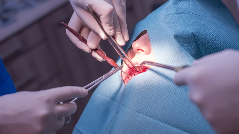 U nang răng là gì? Những thông tin quan trọng cần biết 4