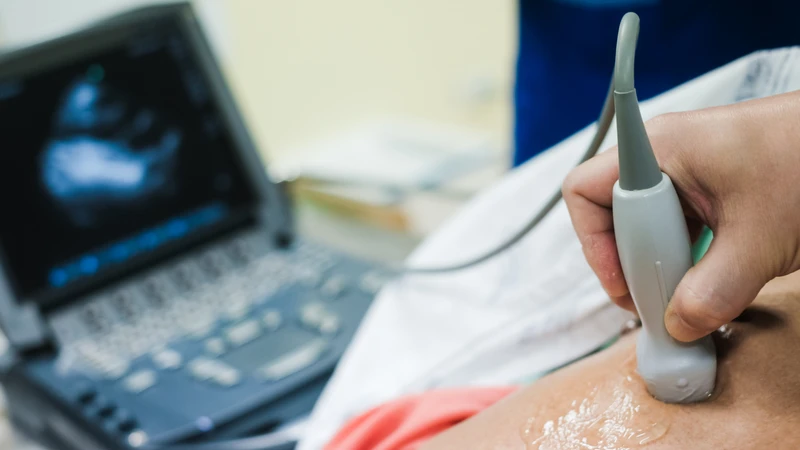 Siêu âm là phương pháp quan trọng giúp phát hiện và đánh giá u nhầy, đặc biệt là u nhầy ở tim