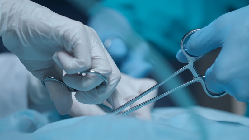 Điều trị u nhầy ruột thừa chủ yếu bằng phẫu thuật, tùy thuộc vào kích thước và mức độ của khối u