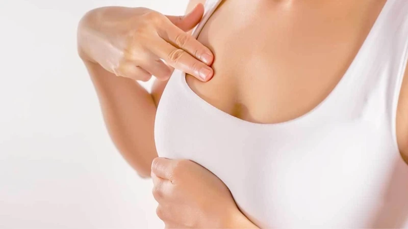 Nguyên nhân chính xác gây u vú BIRADS chưa được xác định cụ thể