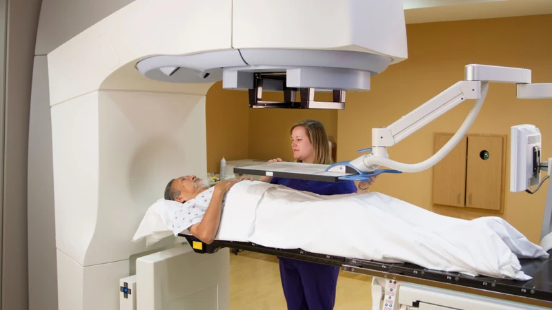 Việc từng điều trị bằng bức xạ ion hóa liều cao có thể làm tăng nguy cơ xuất hiện sarcoma xương thứ phát
