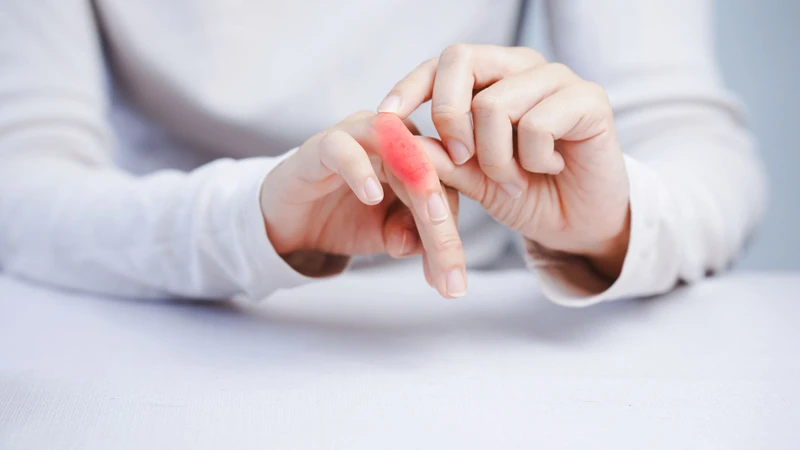 Vùng xương bị di căn có thể xuất hiện tình trạng bị sưng nhẹ