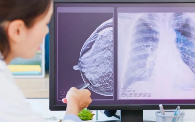 Nên khám vú định kỳ để phát hiện sớm các bất thường và điều trị kịp thời